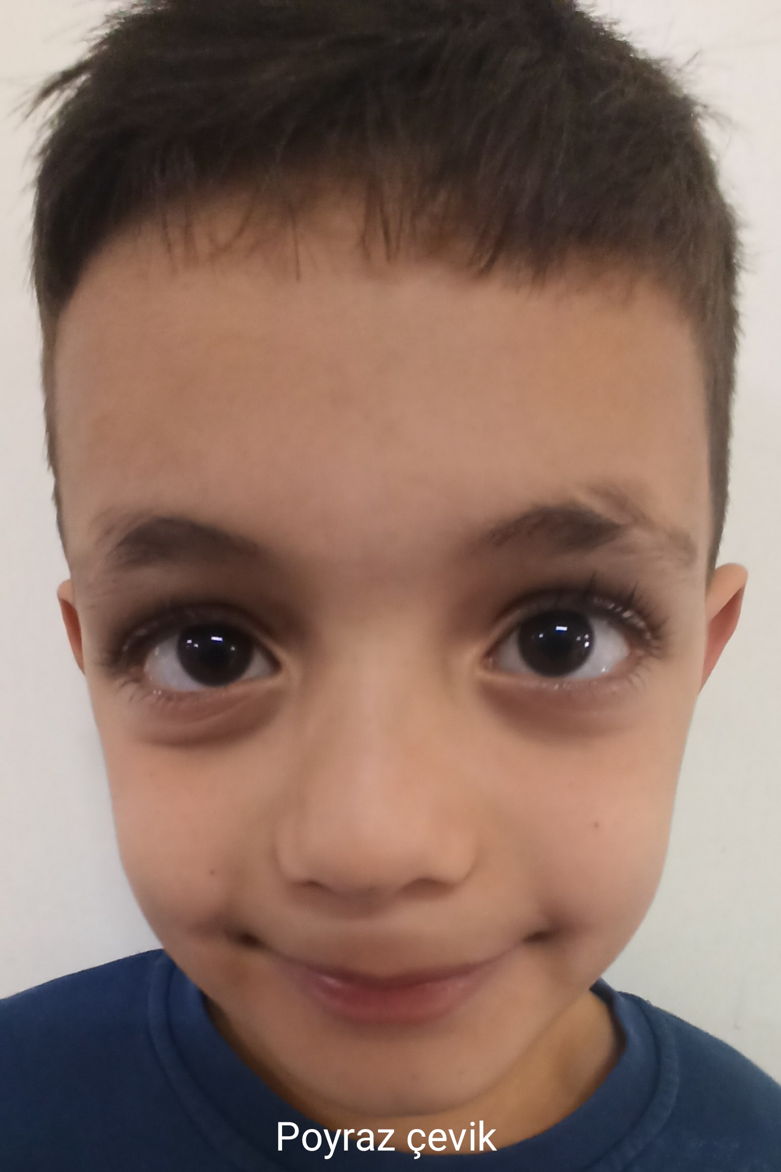Poyraz ÇEVİK